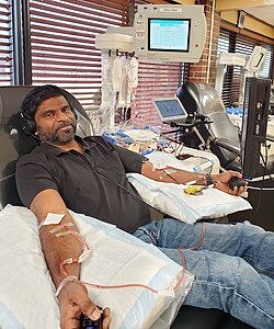Platelet donation by a double catheter at a US donation center