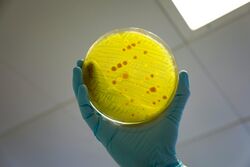Antimicrobial resistance.jpg