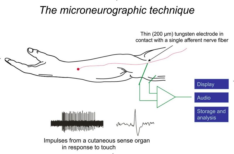 File:Microneurography, experimental setup, schematic.jpg