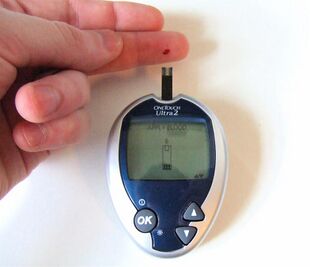 Blood Glucose Testing.JPG