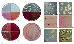 E. coli colonies