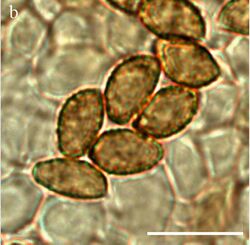 Cortinarius ainsworthii spores.jpg