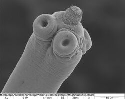 Hymenolepis microstoma.jpg