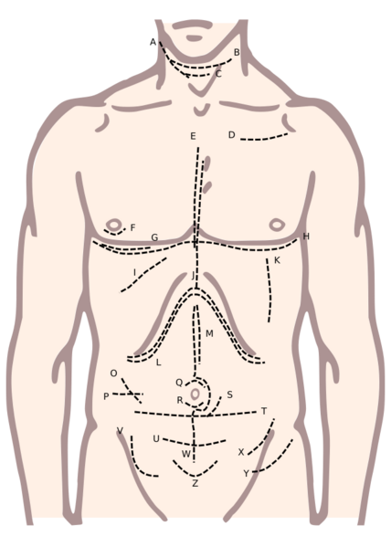 File:Incisions of the torso.svg