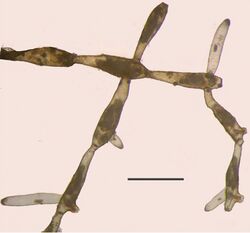 Paludicella articulata (10.3897-zookeys.774.21769) Figure 10.jpg
