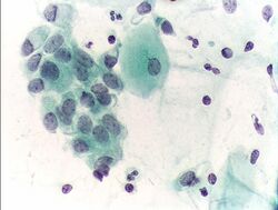 Pap test endocervical cells.JPG