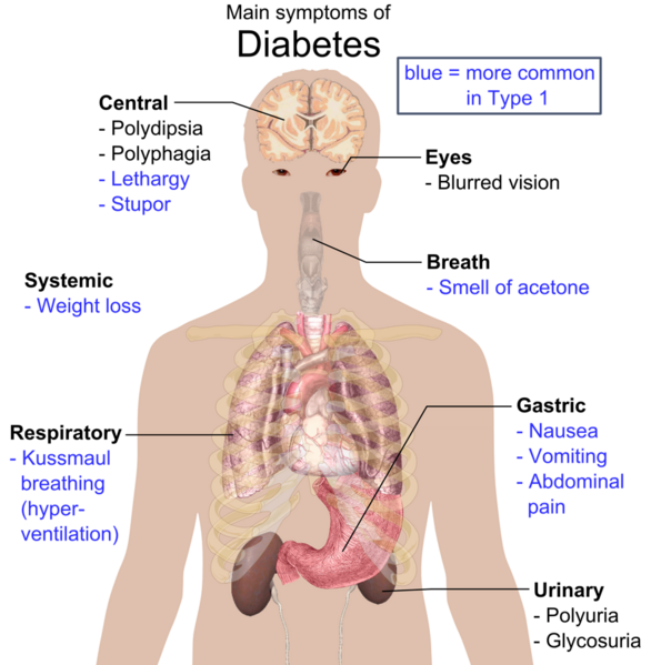 File:Main symptoms of diabetes.png