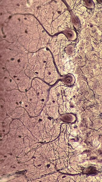 File:Neurons (Purkinje cells).jpg