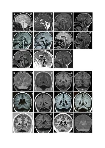 23 examples of Magnetic resonance imaging