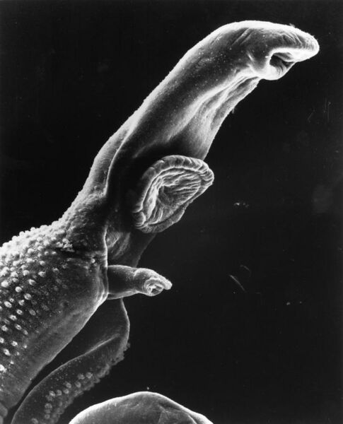 File:Schistosome Parasite SEM.jpg