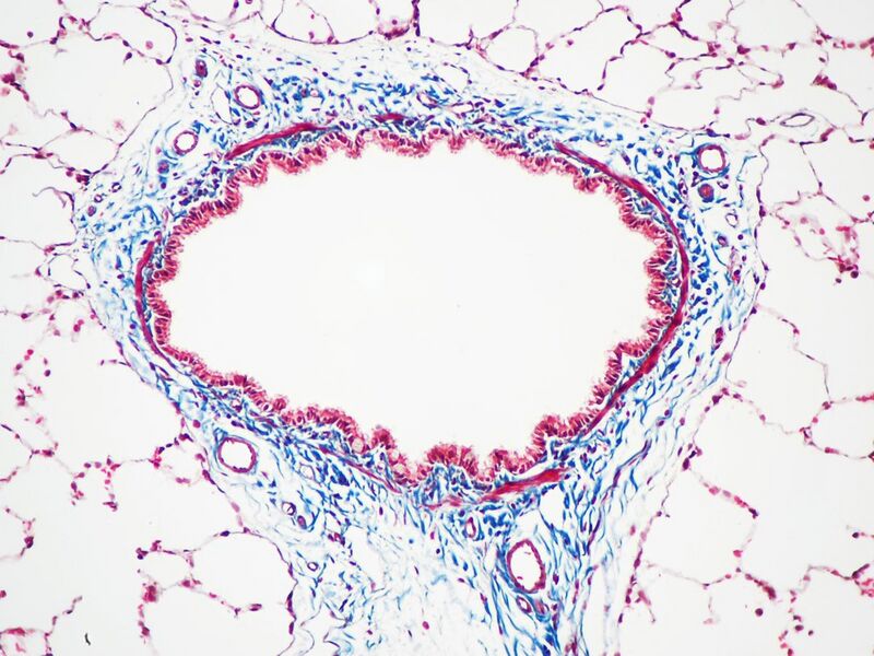 File:Masson's Trichrome Stain (Rat Airway Section).jpg