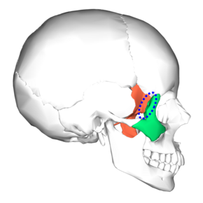 Sphenoid bone and zygomatic bone - lateral view4.png