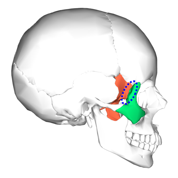 File:Sphenoid bone and zygomatic bone - lateral view4.png