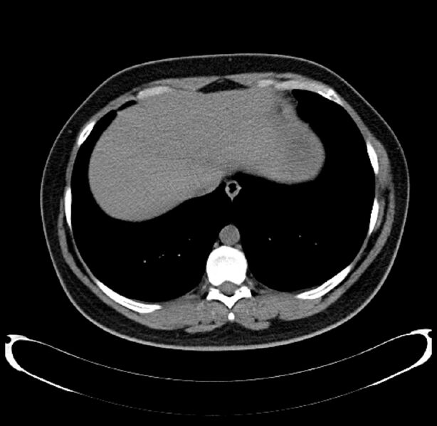 File:CT Scan Thorax Liver.jpg