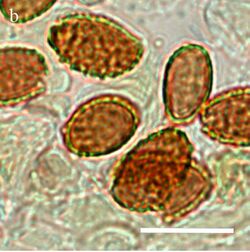 Cortinarius subsaniosus spores.jpeg