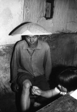 Chinese barefoot doctor performing acupuncture.jpg