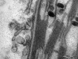Chloroplast in leaf of Anemone sp TEM 85000x.png