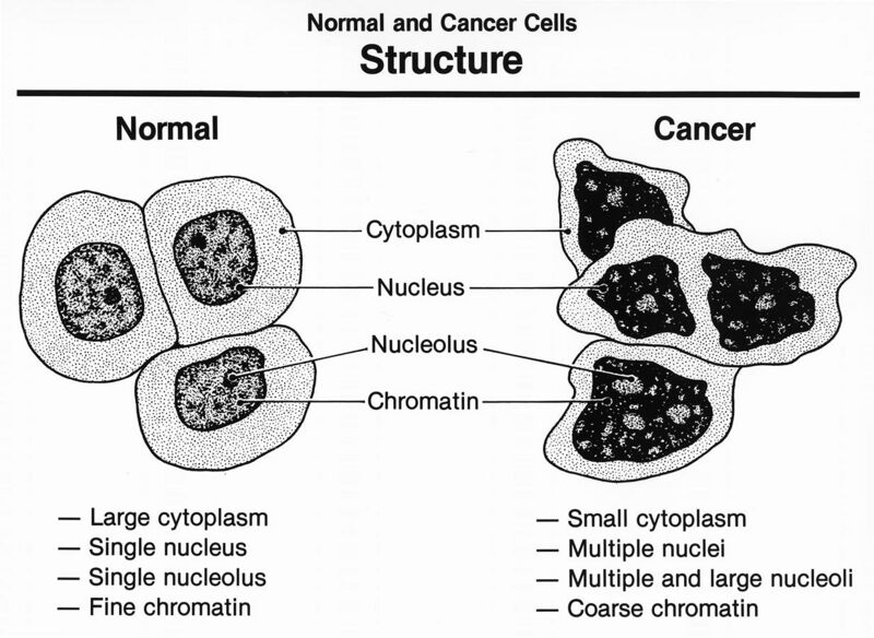 File:Normal and cancer cells structure.jpg