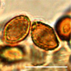 Cortinarius britannicus spores.jpeg