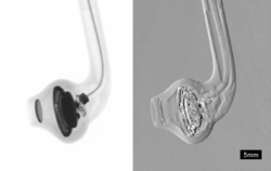 X-ray-PhaseContrast-EarPlug.png