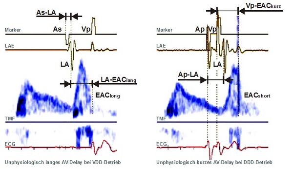 AV-Delay Optimierung