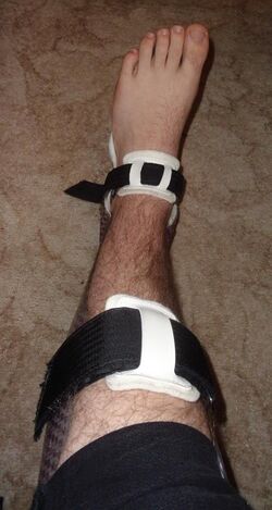 Ankle foot orthosis splint.JPG
