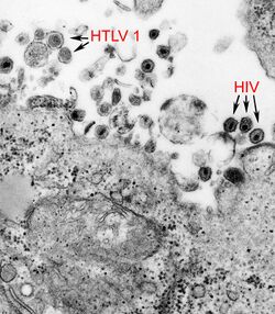 a micrograph showing both Human T-lymphotropic virus 1 and HIV