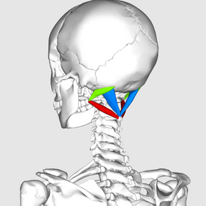 Suboccipital triangle11.png