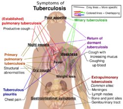 Tuberculosis symptoms.svg