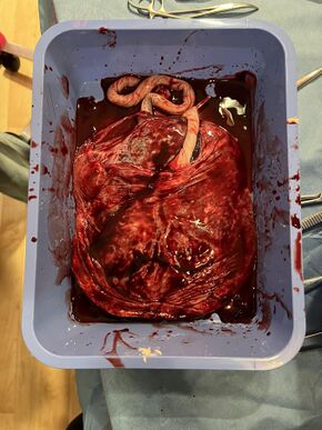 Healthy Placenta.jpg