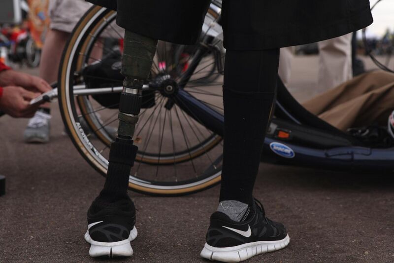 File:Prosthetic leg cycling.jpg