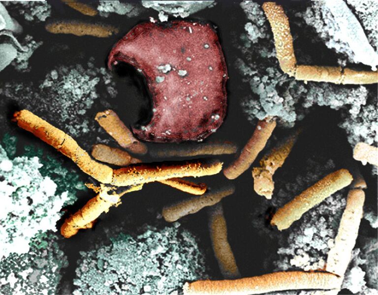 File:Anthrax color enhanced micrograph.JPG