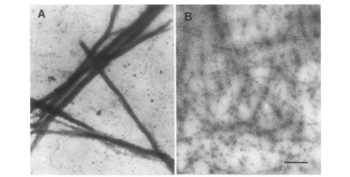 Formation of actin bundles by recombinant I-plastin. Shown are electron micrographs of negatively stained F-actin incubated with I-plastin either in the absence of calcium (A) or in the presence of calcium (B).