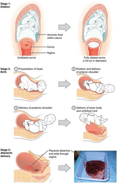 File:2920 Stages of Childbirth-02.jpg