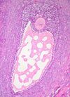 Graafian Follicle, Human Ovary (3595817584).jpg