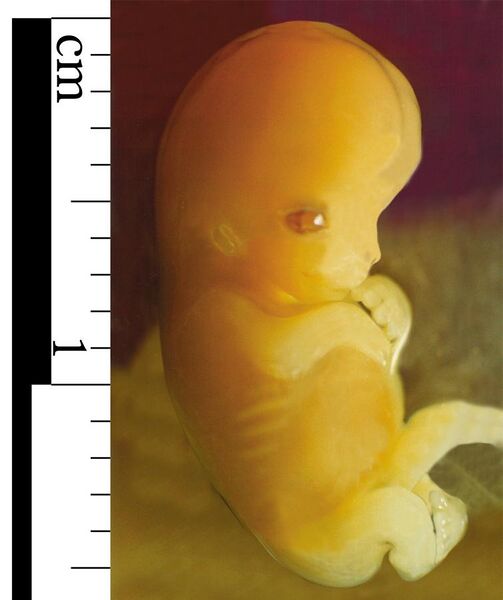 File:Embryo 7 weeks after conception.jpg