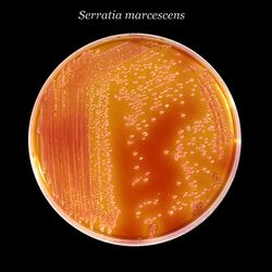 Serratia marcescens 01.jpg