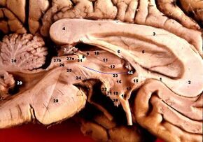 Human brain left midsagitttal view closeup description 2.JPG