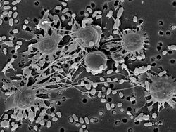 Amoebal and cystic cells of Parvularia atlantis