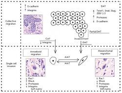 Patterns of cancer cell invasion.jpg