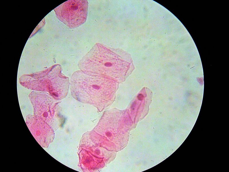 File:Cheekcells stained.jpg