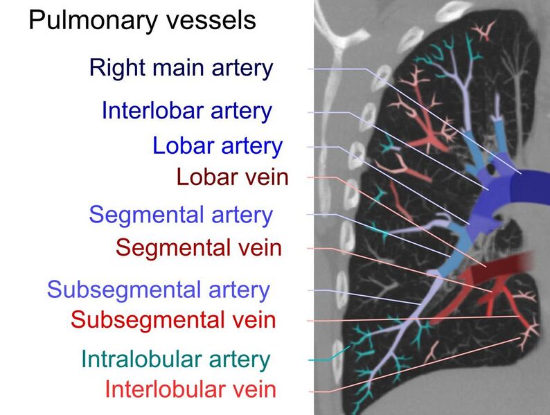File:Computed tomograph of pulmonary vessels.jpg