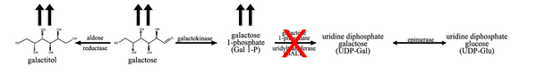 If the activity of the enzyme galactose 1-phosphate uridyltransferase is decreased, there is a buildup of the precursors in the pathway, mainly galactose 1-phosphate and galactose.