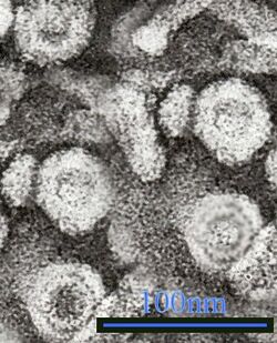 TEM micrograph showing Hepatitis B virus virions