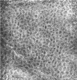 Confocal image of the stratum granulosum.jpg