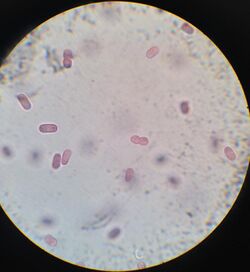 Chromatium Okenii al microscopio.jpg