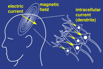 Magnetoencephalography.svg