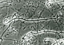 Uncinocarpus reesii microscopic.jpg