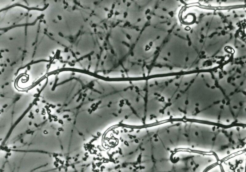 File:Uncinocarpus reesii microscopic.jpg