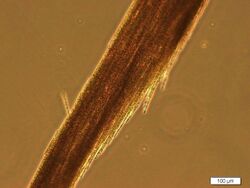 Aphanizomenon colony fluorescence microscopy.jpg